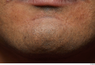 HD Face Skin Henri Sanaky chin face skin pores skin…